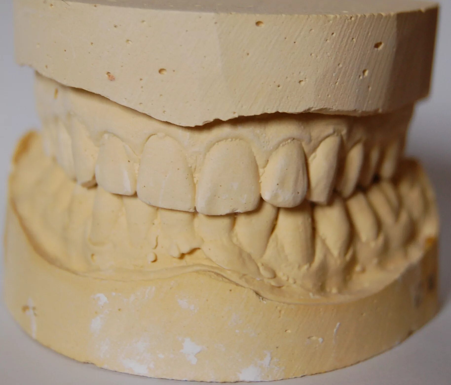 Изготовление гипсовой модели. Гипсовая модель зубов. Гипсовые модели челюстей. Гипсовый слепок зубов. Гипсовая Медель челючти.