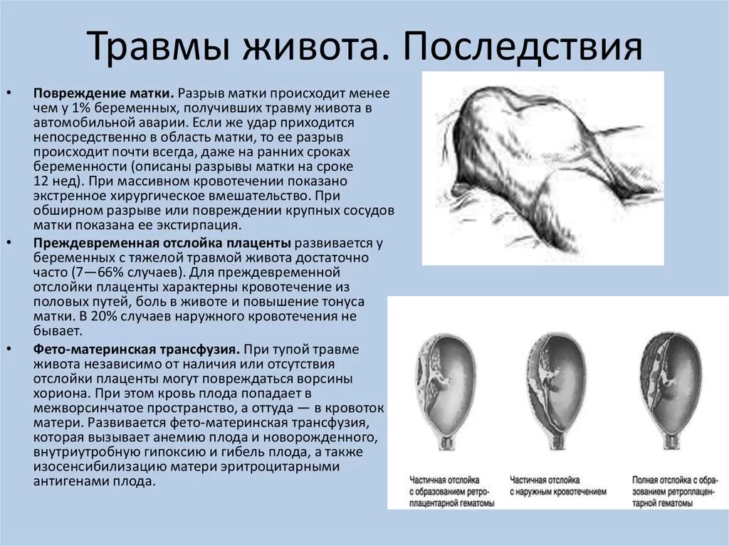 Травмы живота при беременности. Осложнения травм живота. Осложнения закрытых травм живота. Ранение в живот последствия.