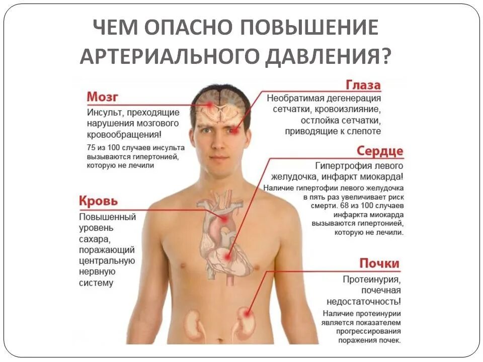 Опасно для жизни заболевания. Опасность артериального давления. Чем опасно повышенное артериальное давление. Ад заболевание. Опасность повышенного артериального давления.