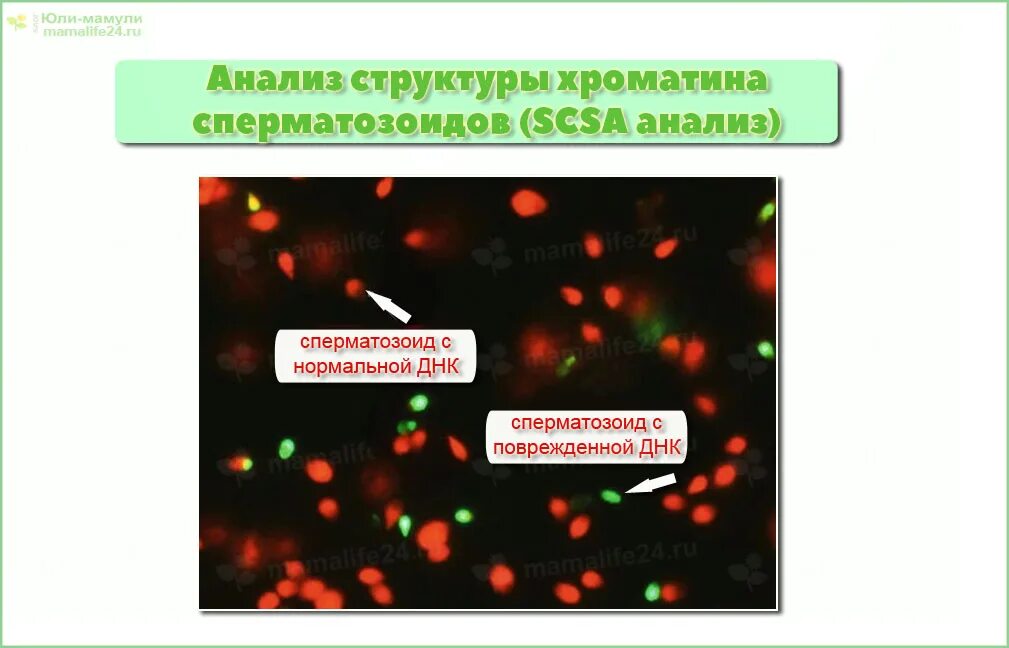 Фрагментация днк методы. Спермограмма с ДНК фрагментацией. Фрагментация ДНК сперматозоидов. Тест на фрагментацию ДНК сперматозоидов. Фрагментация спермограммы туннель.