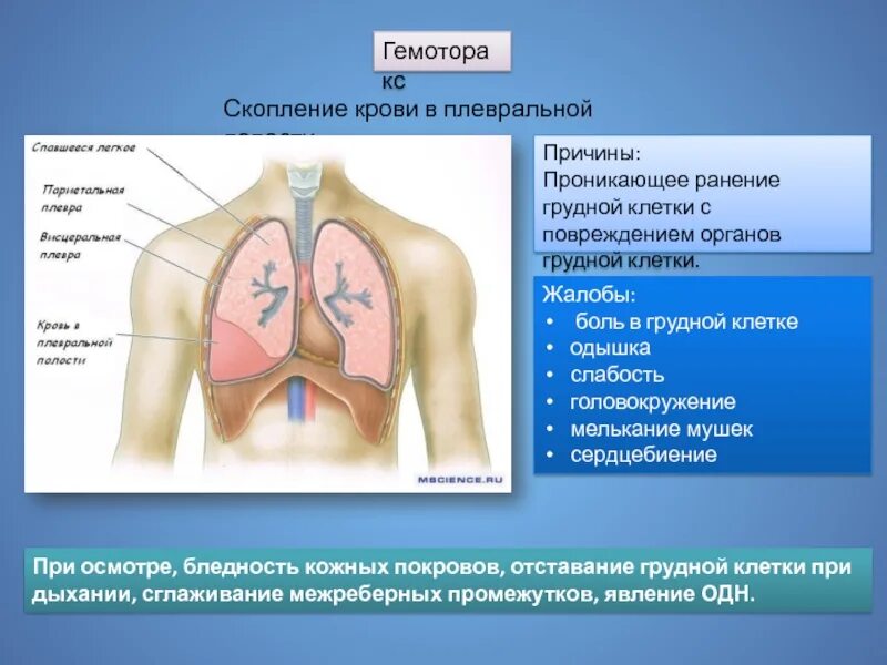 Хирургические заболевания грудной клетки. Гемоторакс это скопление крови в. Гемоторакс это скопление в плевральной полости. Скопление крови в грудной полости. Повреждение грудной клетки и органов грудной полости.