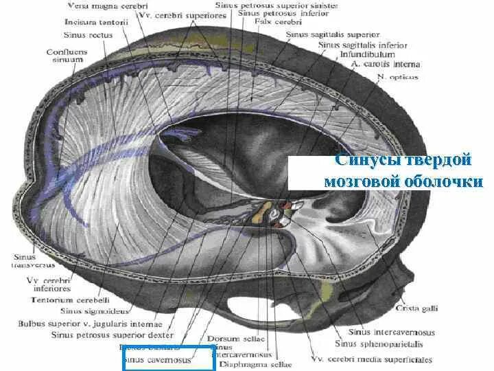 Синусы твердой оболочки мозга. Синусы твердой оболочки головного мозга. Синусы твердой мозговой оболочки гистология. Синусы твердой мозговой оболочки (Sinus durae matris encephali) по в.в. Квашуку (2002):. Хирургическая анатомия синусов твердой мозговой оболочки.
