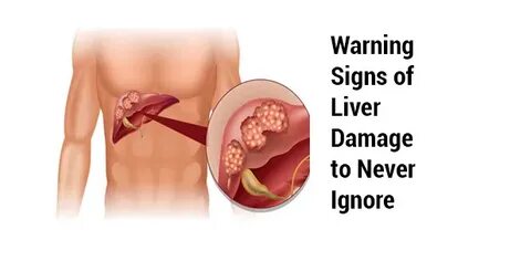 Warnings warn ignore