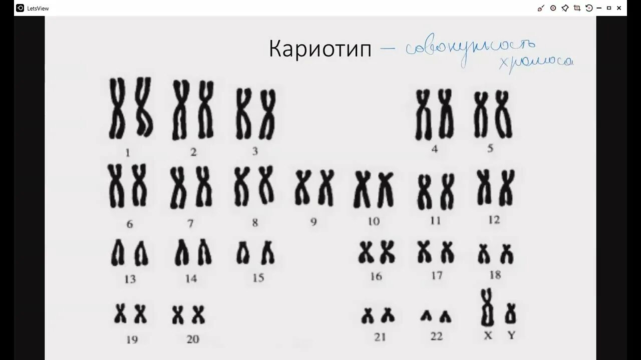 Без хромосомный. Синдром вильямса кариотип. Хромосома рисунок. Хромосомы на прозрачном фоне. Без хромосомный.