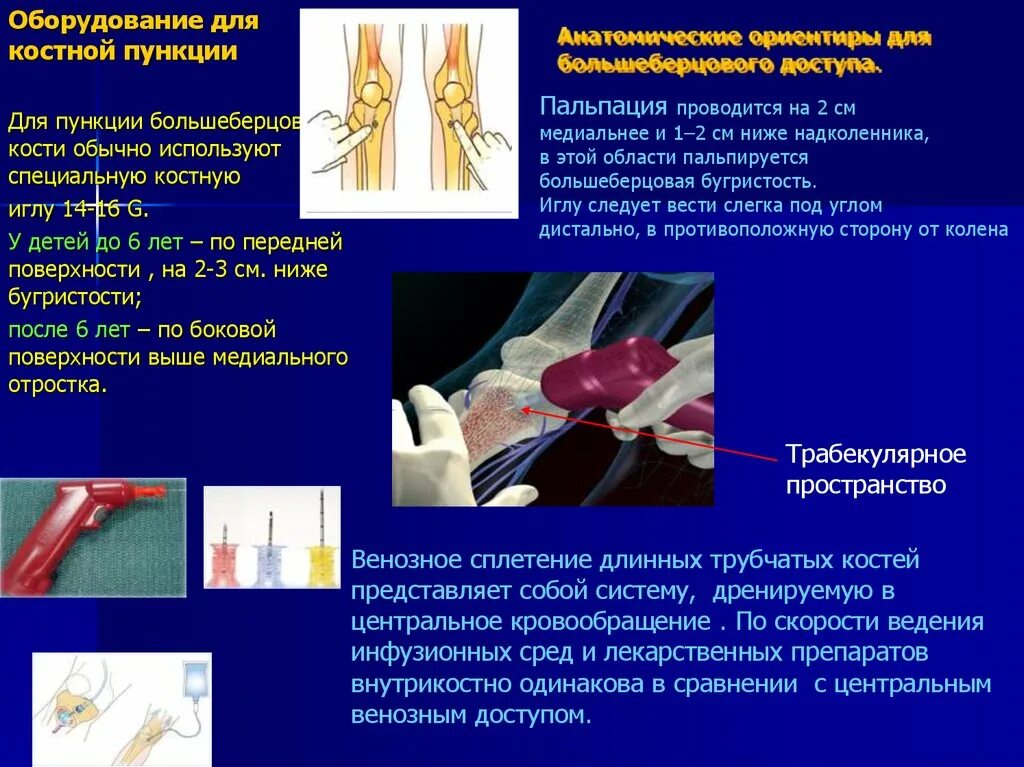 Стернальная пункция презентация. Специальной иглой для внутрикостной пункции. Для пункции кости применяется игла. Пункция большеберцовой кости.
