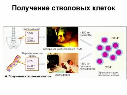 Метод стволовых клеток