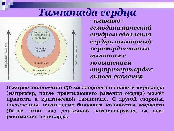 Тампонада сердца симптомы. Тампонада сердца механизм развития. тампонада сердца патогенез. тампонада сердца патофизиология.