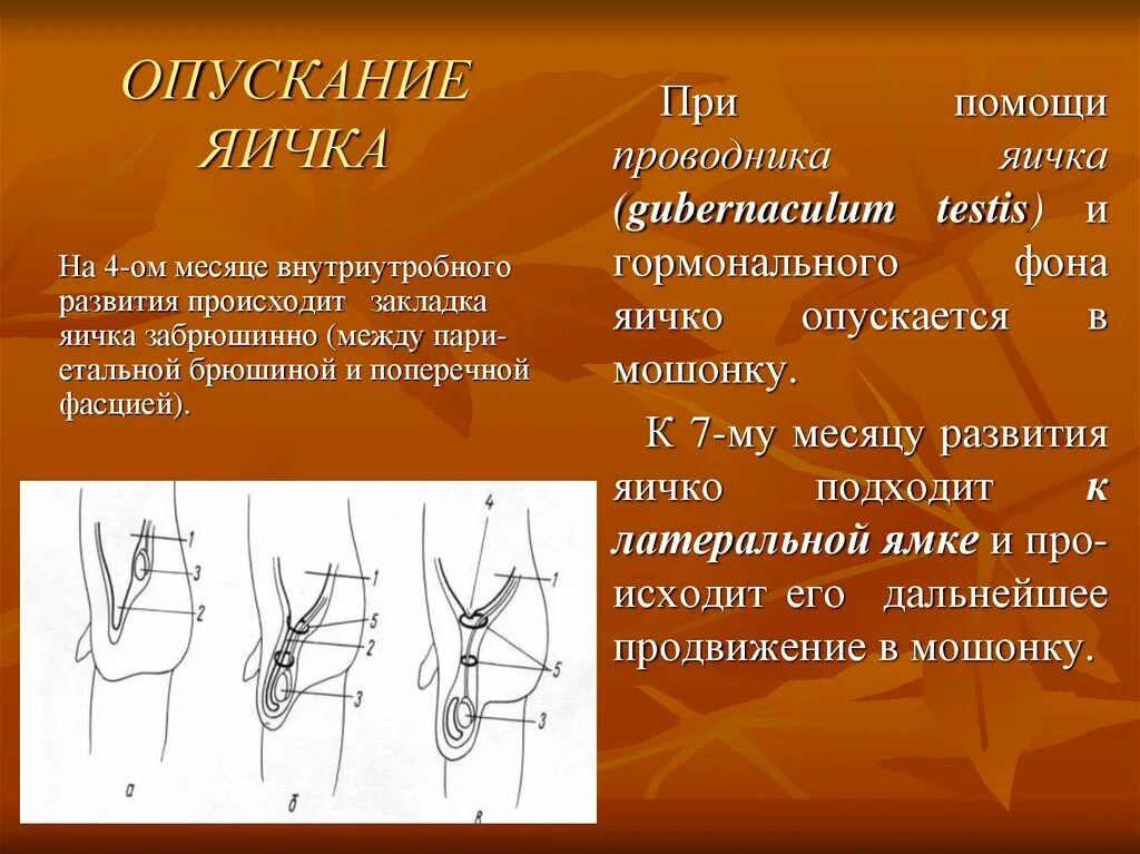 Опускание яичка у ребенка. Если яички не опустились у ребенка.