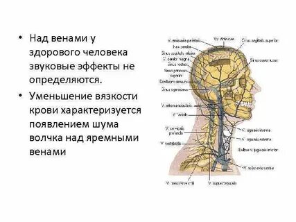 Шум волчка