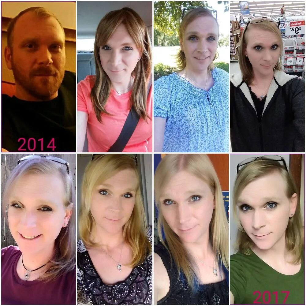 Before transition. Mtf hrt 2025г. mtf hrt timeline. mtf transition before and after. hrt mtf transition.
