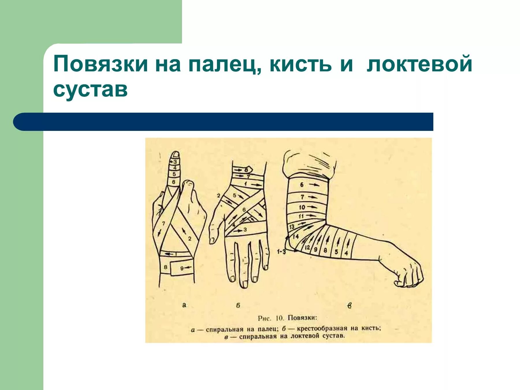 Наложение повязки варежка алгоритм. Виды повязок. Повязки ОБЖ. Типы бинтовых повязок рисунок. Виды повязок бинтом.