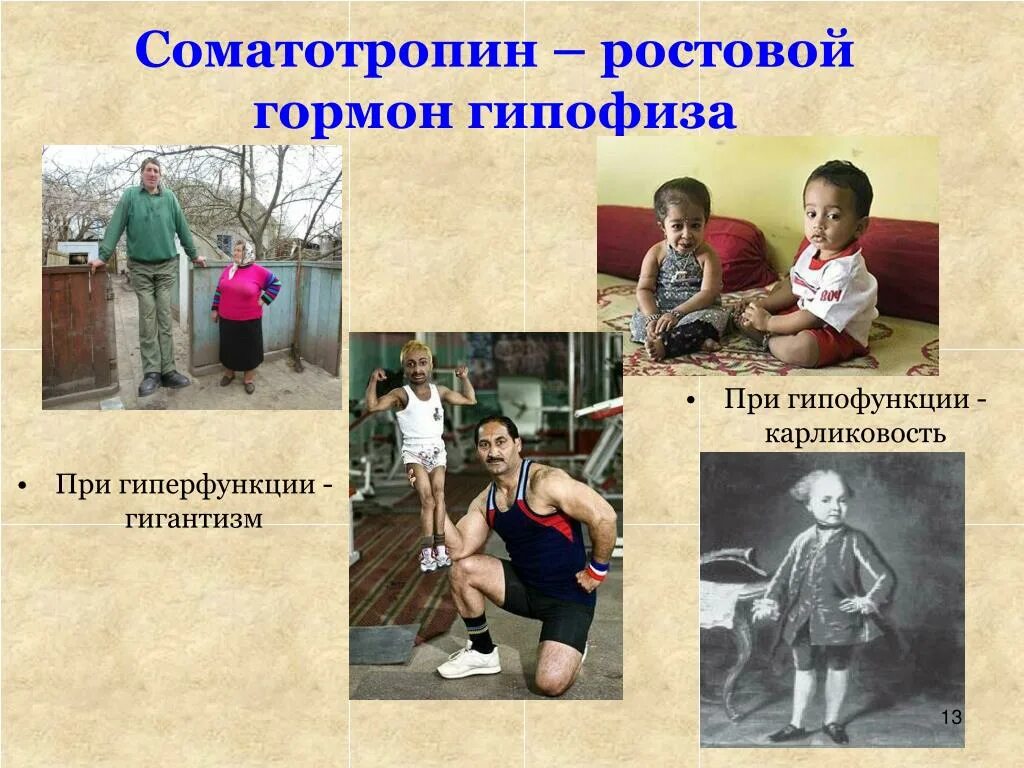 Гипофиз гиперфункция. Гормон соматотропин гиперфункция. гиперфункция гипофиза гигантизм. соматотропный гормон гипофункция.