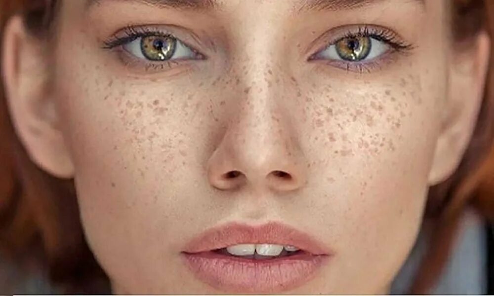 Freckles перевод. Веснушки на носу. Красивые веснушки. Веснушки на лице. Девушка с веснушками.