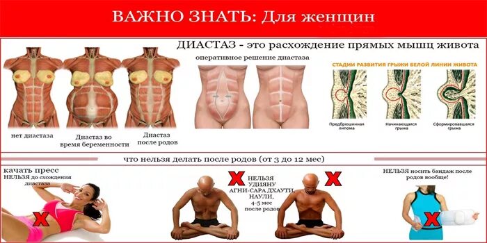 Лфк при диастазе прямых мышц живота. Диастаз мышц живота 1 степени. Тренировки на пресс при диастазе прямых мышц живота. Упражнения при диастазе. Упражнения при диастазе.
