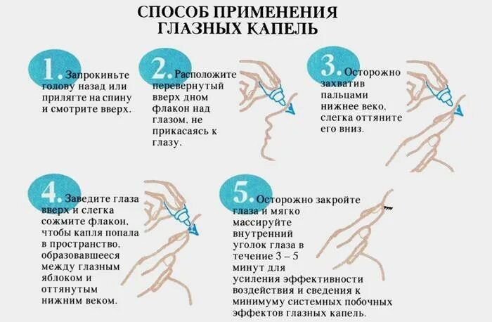 Как закапывать глазные капли самому себе. Закапывание капель в глаза алгоритм. Как правильно капать капли в глаза взрослым. Куда правильно капать глазные капли