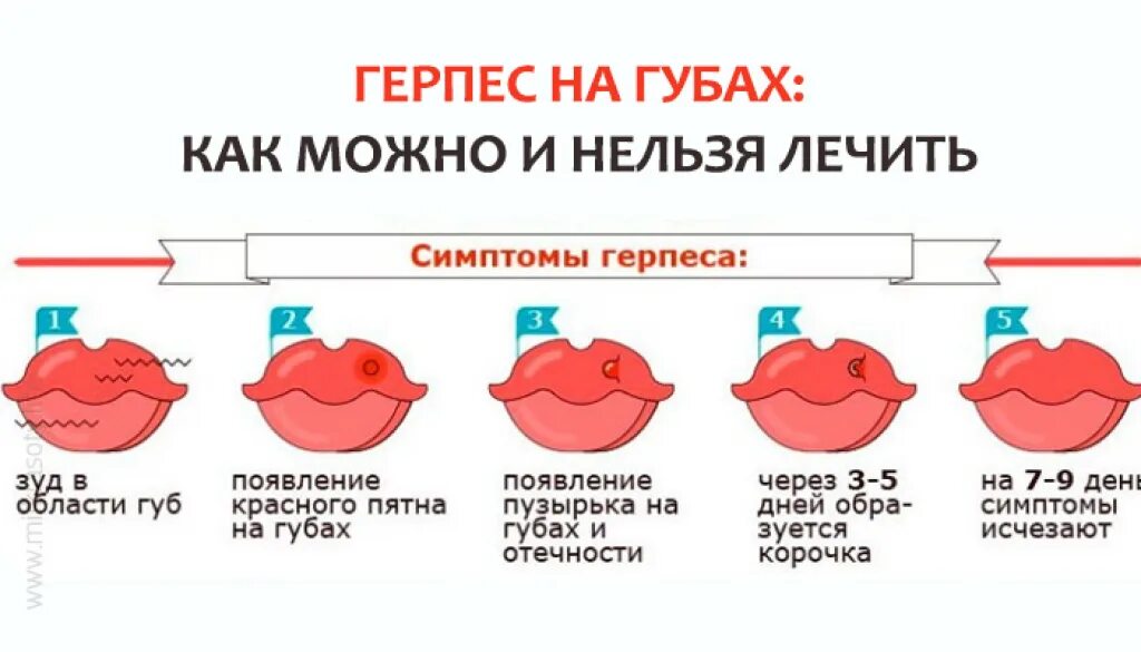 Почему появляется герпес на губах причины. Почему появляется герпес на губах причины