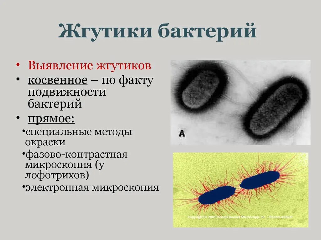 Передвижение бактерий. Метод обнаружения жгутиков у бактерий. Метод косвенного выявления жгутиков у бактерий. Прямые методы выявления жгутиков у бактерий. Структура бактериальной клетки жгутики.