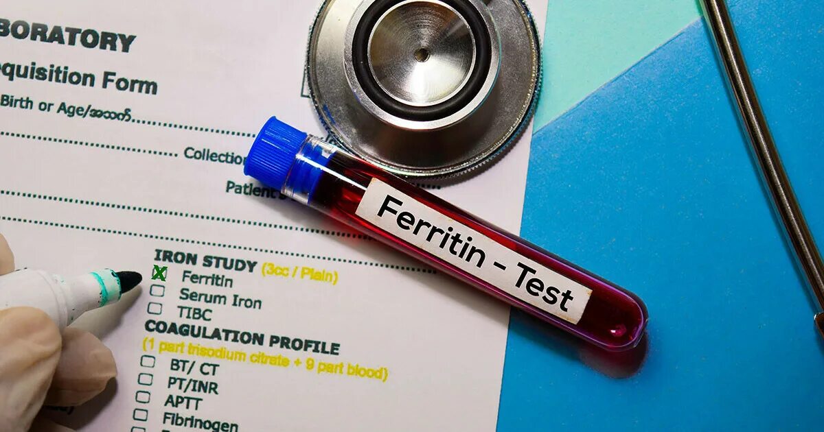 Как сдавать анализ на железо и ферритин. Ferritin test. ферритин.