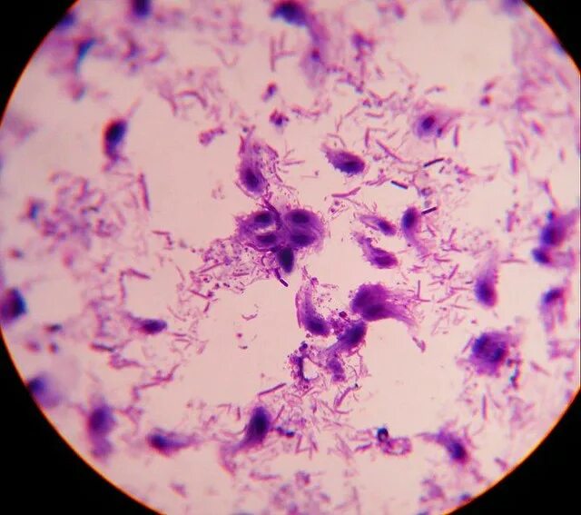 Трихомонада (Trichomonas vaginalis) (определение ДНК), (качеств.