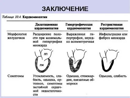 Гипертрофическая кардиомиопатия клинические