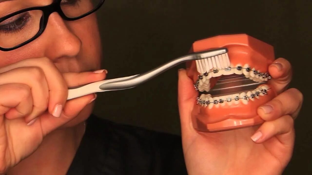 Можно жвачку с брекетами. Ортодонтическая зубная щетка для брекетов электрическая. Гигиена полости рта с брекет системой. Алгоритм чистки зубов с брекетами. Профессиональная гигиена полости рта с брекетами.