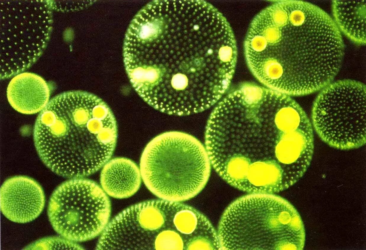 Фитопланктон диатомовые водоросли. Одноклеточные планктонные водоросли. Планктонные водоросли фитопланктон. Синезеленые водоросли фитопланктон.