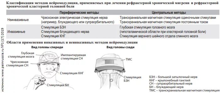 Что происходит при мигрени. Мигрень и кластерная головная боль. Пучковая кластерная головная боль. Кластерная головная боль критерии. Мигренозная кластерная головная боль.