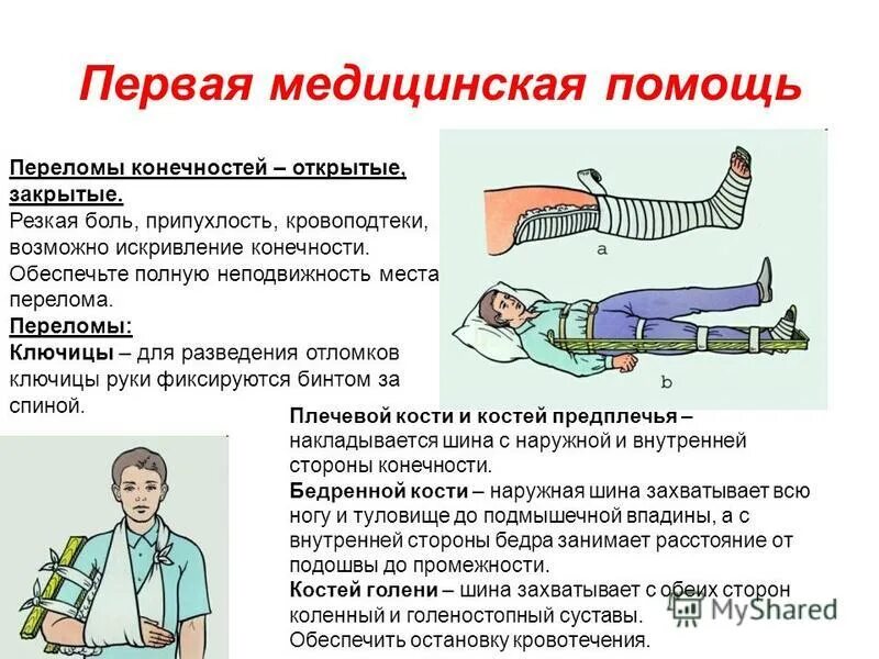 для переломов конечностей характерно