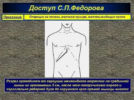 Косой разрез