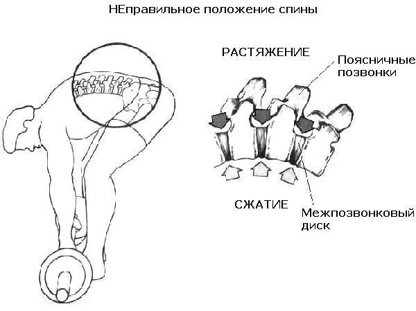 Нагрузка на поясницу. Положение на спине. Неправильное положение спины. Неправильное расположение спины. Схема позвоночника при наклоне вперед.