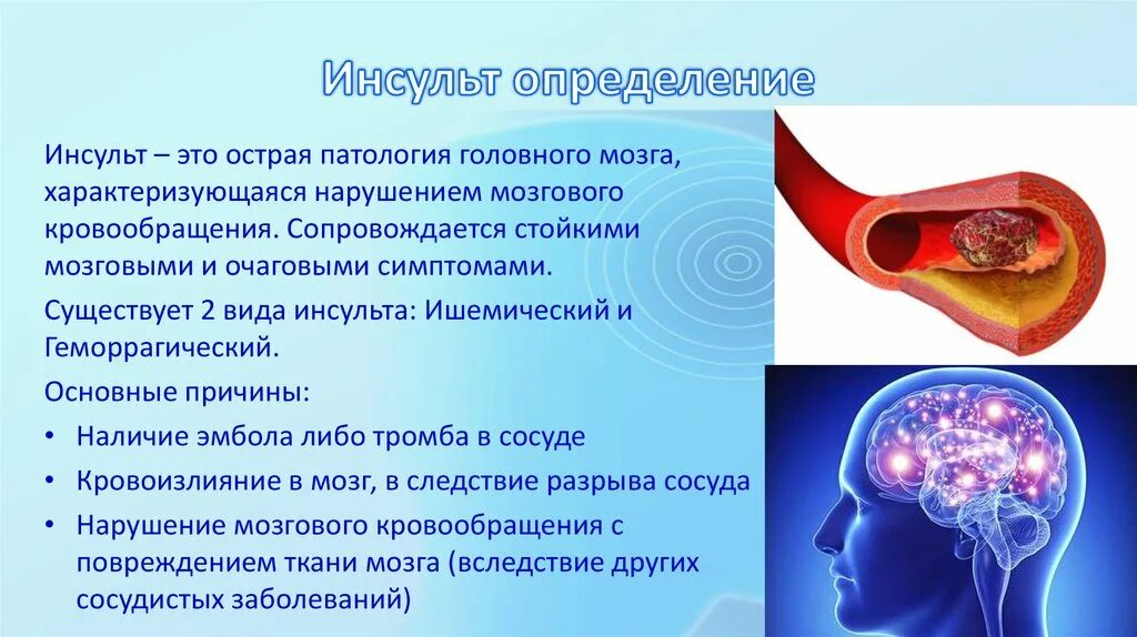 Инсульт. Ишемический инсульт презентация. Нарушение мозгового кровообращения у детей. Инсульт определение.