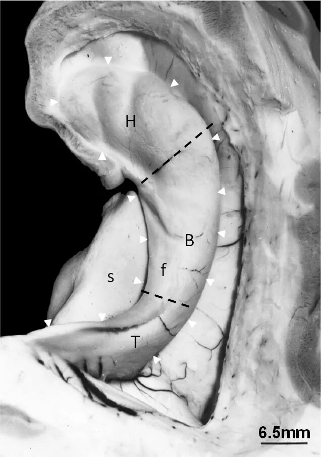 Повреждение гиппокампа. Гиппокамп анатомия. Бехтерев гиппокамп. Hippocampus анатомия. Поле са2 гиппокампа.