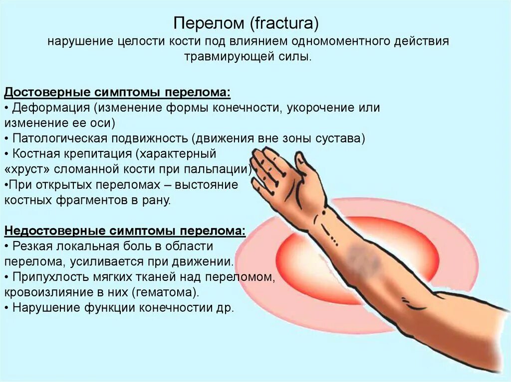 Для перелома характерно тест. Характерные признаки перелома. Специфические признаки перелома. Характерные признаки при переломе. Симптомы при переломе костей.