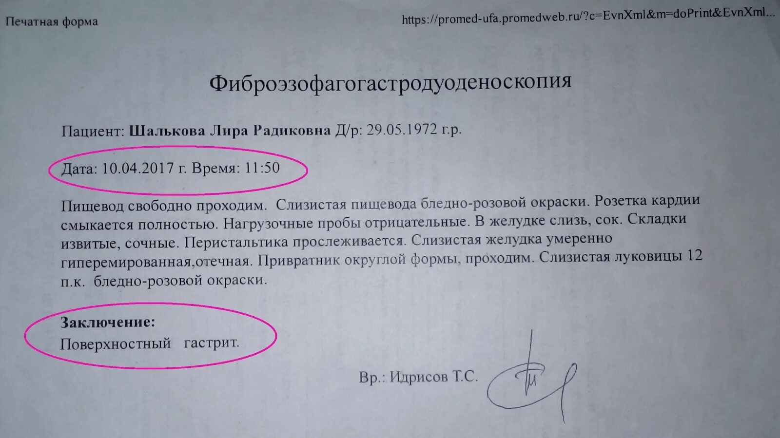 Как расшифровывается фгдс. Заключение фгдс норма. заключение эфгдс норма. фгдс гастрит заключение. фгдс при гастрите заключение.