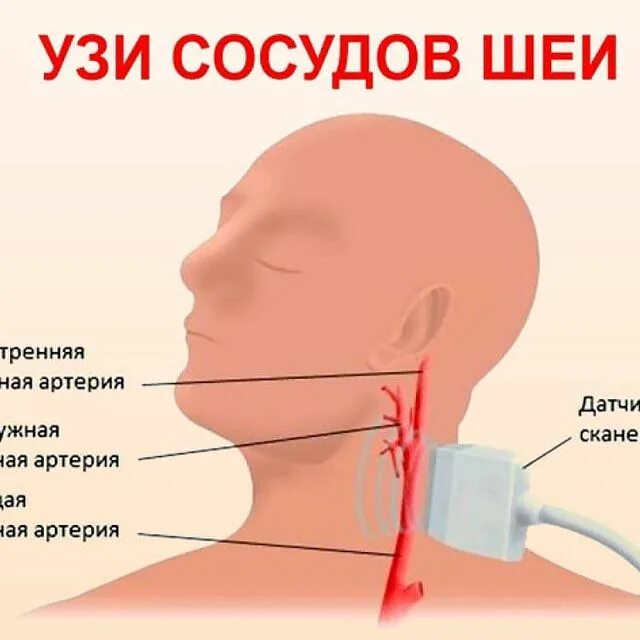 узи брахиоцефальных сосудов. ультразвуковая допплерография (уздг). узи шеи. где можно пройти узи шеи. узи брахиоцефальных сосудов узи сосудов шеи.