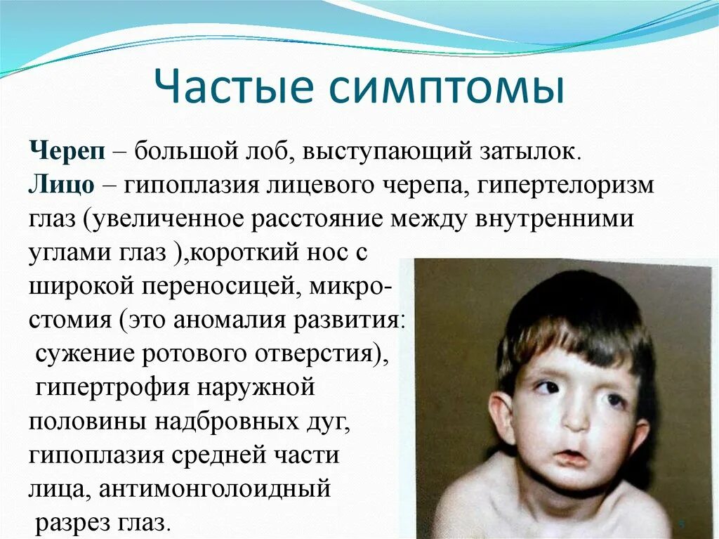 Аномалии развития лицевого черепа. Признаки редкого человека. Признаки редкого человека. Признаки гнилостного процесса. Признаки здорового человека.