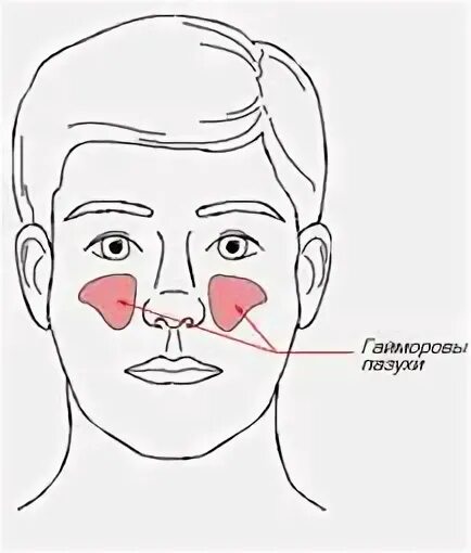 Греть ли нос при заложенности носа. Схема гайморовых пазух. Прогревание носовых пазух.