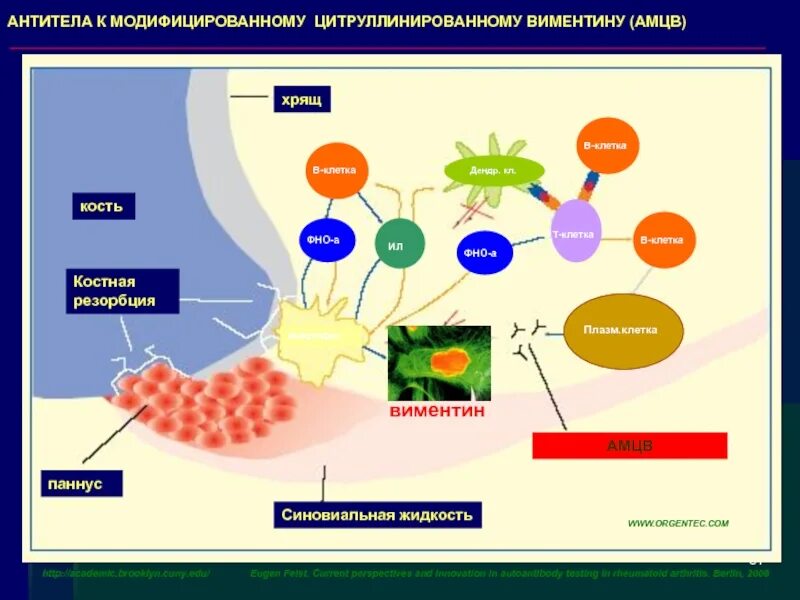Антитела к циклическому цитруллиновому пептиду анализ норма. Антитела к цитруллинированным белкам. Антитела к виментину норма. Антитела к циклическому цитруллиновому пептиду что это. Антитела к циклическому цитруллинированному пептиду аццп что это.