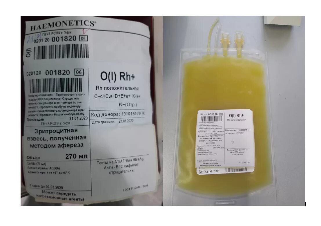 Хранение концентрата тромбоцитов. Концентрат тромбоцитов хранится. Размороженного концентрата тромбоцитов. Концентрат тромбоцитов. Сроки хранения тромбоцитарной массы.