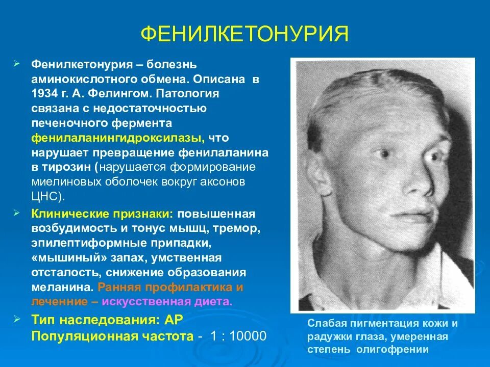 Микроцефалия и умственная отсталость. Наследственные генетические заболевания. Синдром больного человека. Аутосомно доминантные генетические заболевания. Клинические симптомы болезни иценко-кушинга.