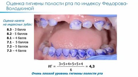 Индекс эффективности гигиены полости рта