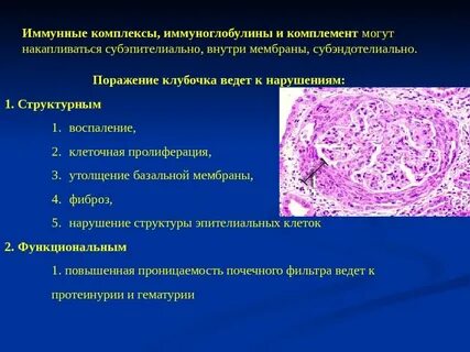 Иммунные комплексы при гломерулонефритах