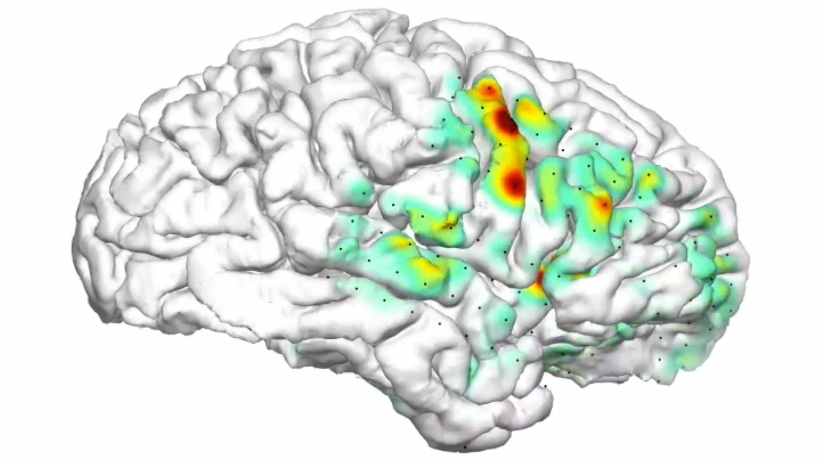 Brain карта. Эпилепсия мозг. Активность мозга. Карта мозга. Мозг эпилептика.