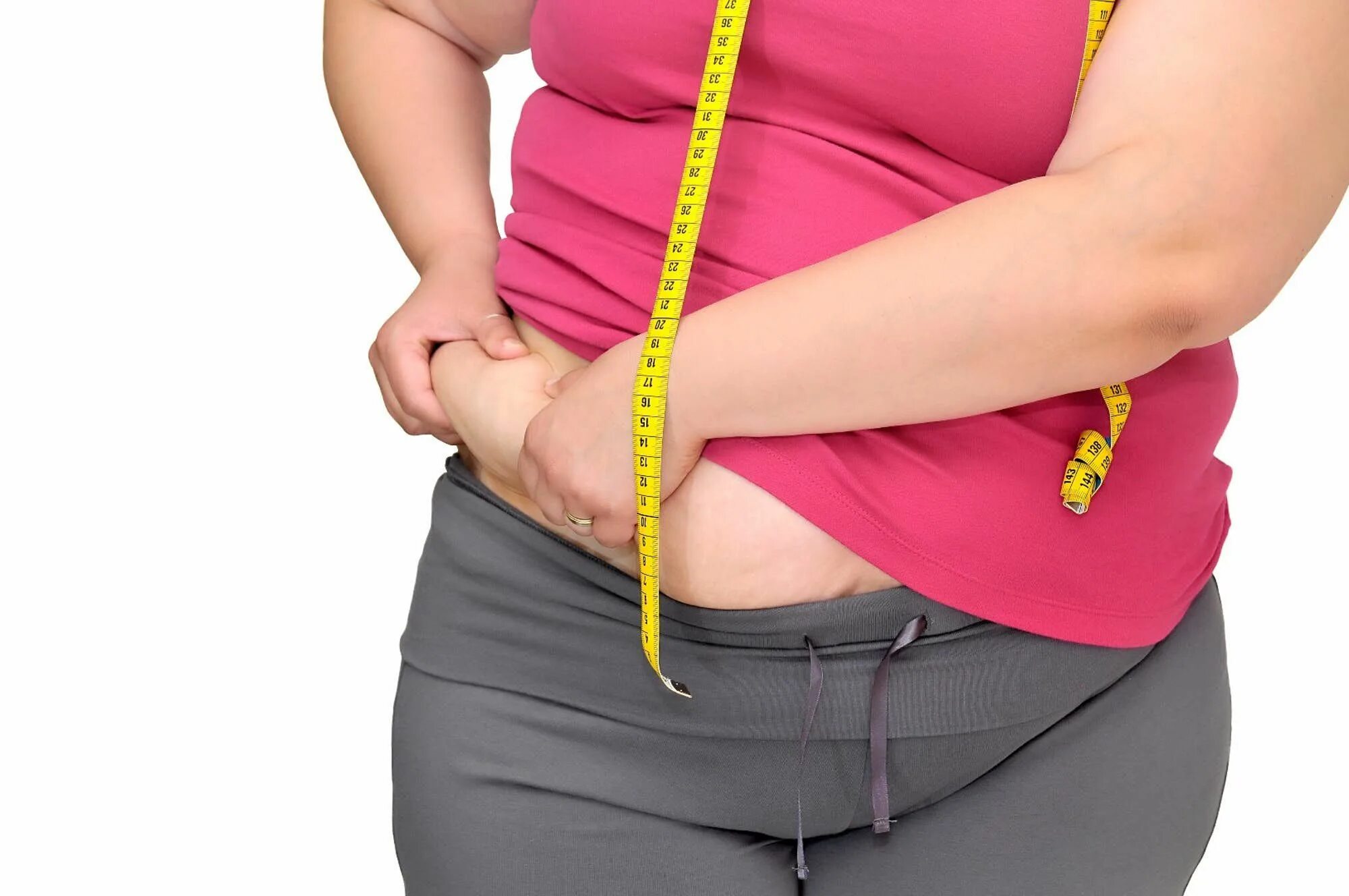Ожирение. Избыточный вес. Лишний вес у женщин.