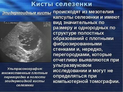 Образование селезенки код
