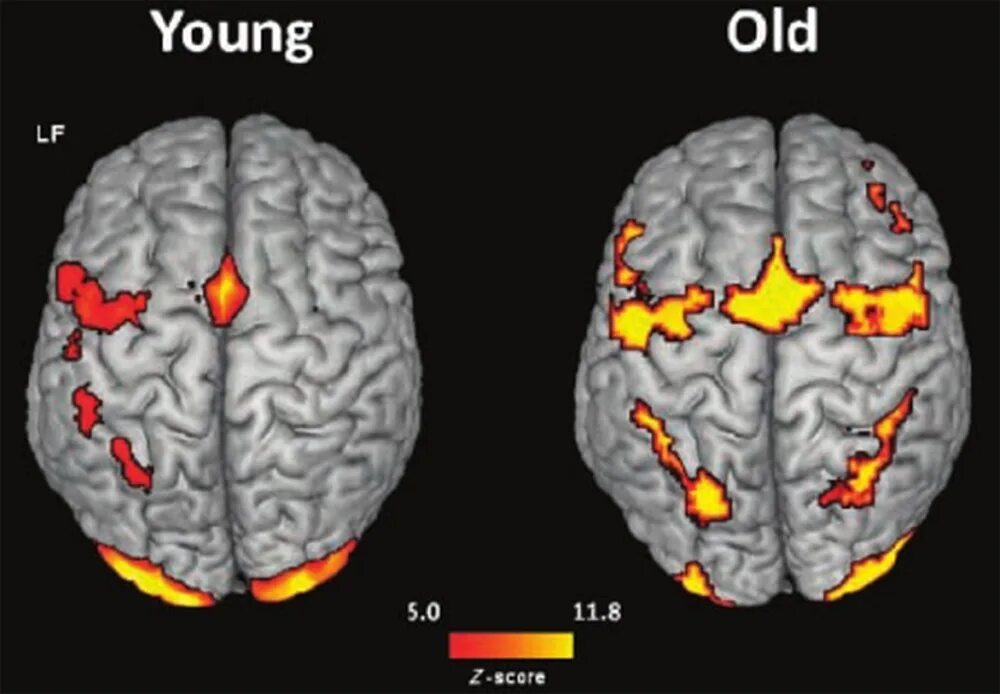 Brain old. Нейропластичность мозга. The Brain Maps игра. Импульс мозга проходящий через мозг.