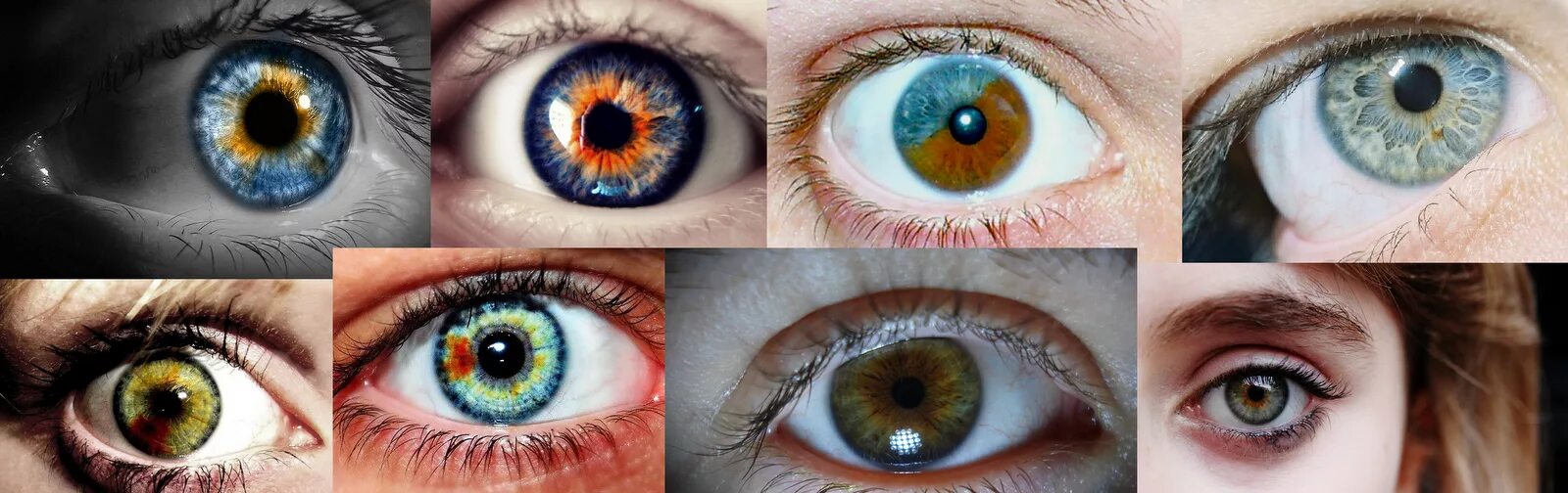 Гетерохромия Радужки глаз. Поликория и гетерохромия. Центральная гетерохромия радужной оболочки глаза. Гетерохромия карих глаз. Несколько насколько