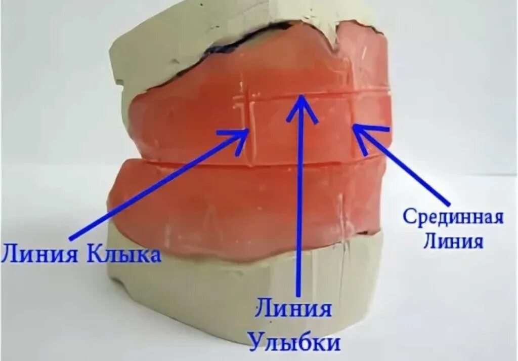 Линия базиса. Прикусние Валек в стоматологии. Фиксация центрального соотношения челюстей. Анатомические ориентиры на окклюзионных валиках. Определение центрального соотношения.