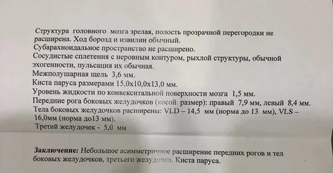Расширение желудочков головного