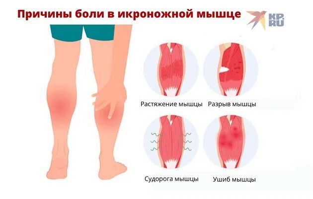 Симптомы растяжения мышц. Симптомы растяжения мышц